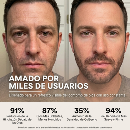 Terapia luz roja para contorno de ojos-Eye-Sonovu™